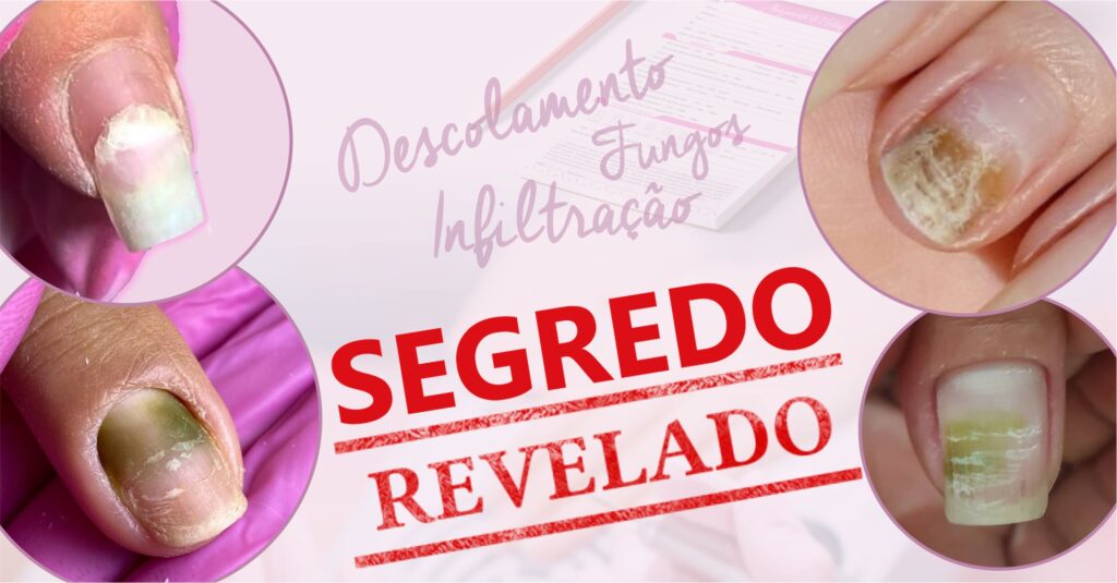 O Poder do Vinagre: Um Remédio Caseiro Que Funciona? - inspiração 2