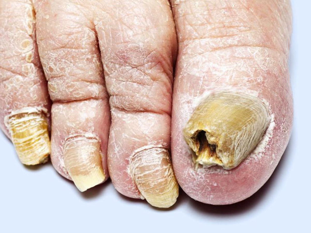 Higienização Impecável: O Primeiro Passo Para a Cura - inspiração 2