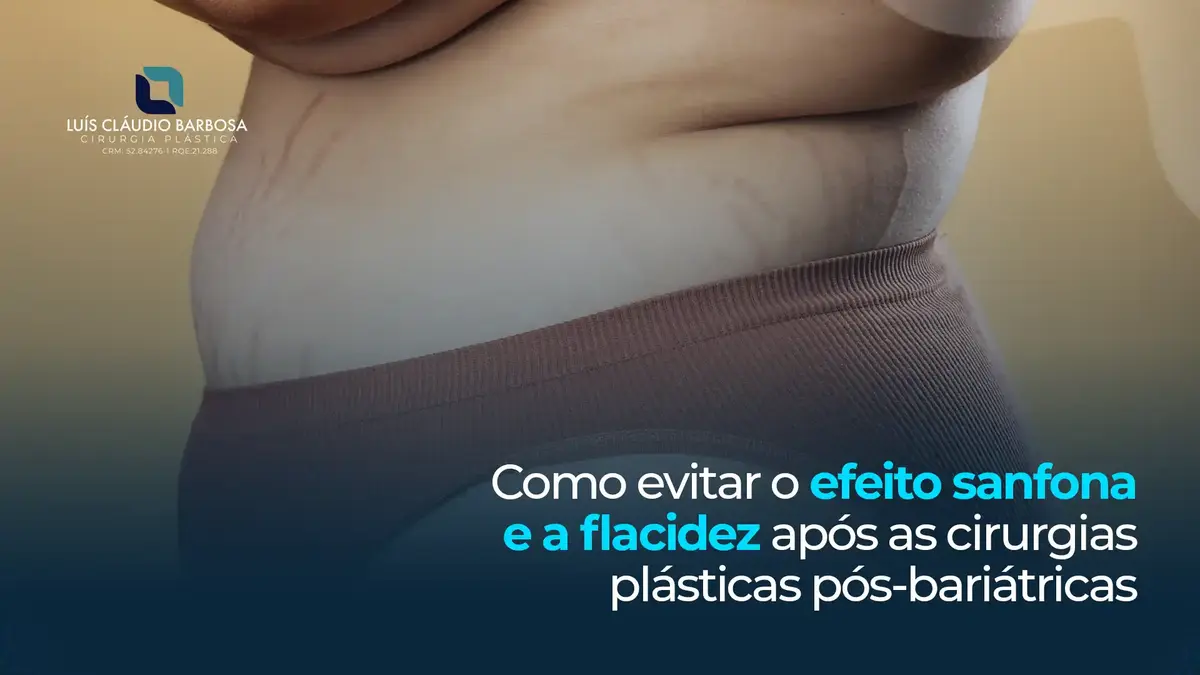 Gerenciando o Estresse: Como Ele Afeta Seus Hábitos Alimentares - inspiração 1