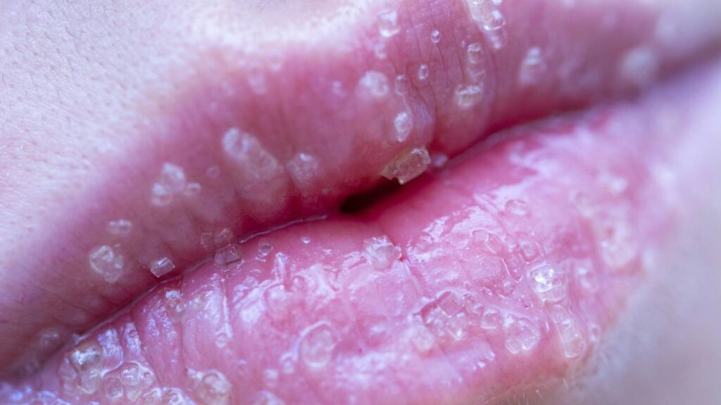 Finalização Essencial: Hidratação Pós-Esfoliação - inspiração 2