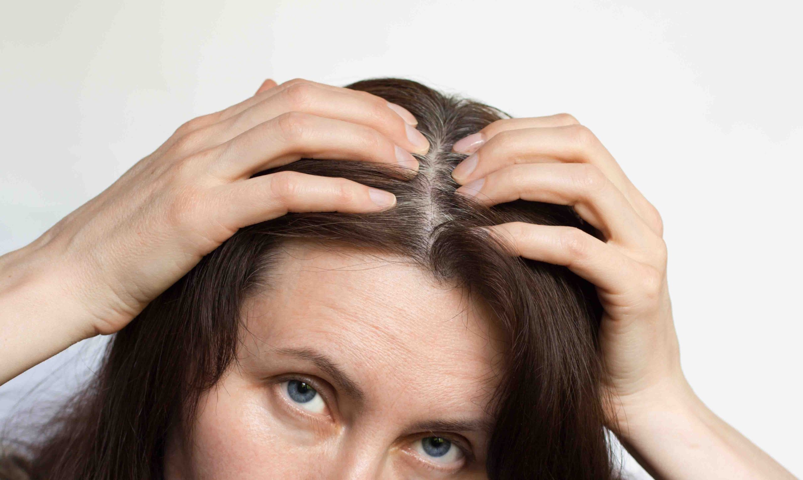 Argila Verde: A Grande Aliada para Absorver o Excesso de Sebo - inspiração 2