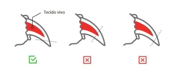 Especial atenção ao 'dedo em lobo' ou garra vestigial - inspiração 2