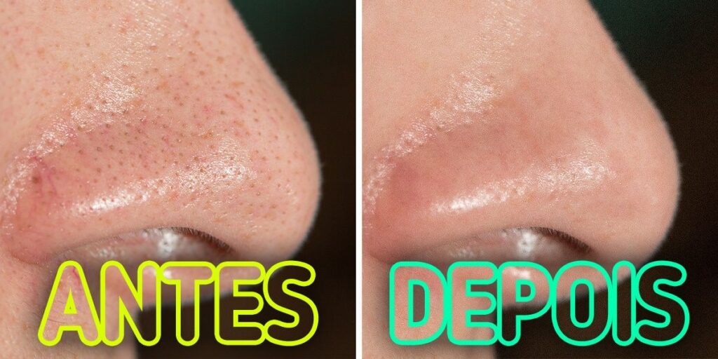 Água Termal ou Floral: Um Toque Refrescante e Matificante - inspiração 2