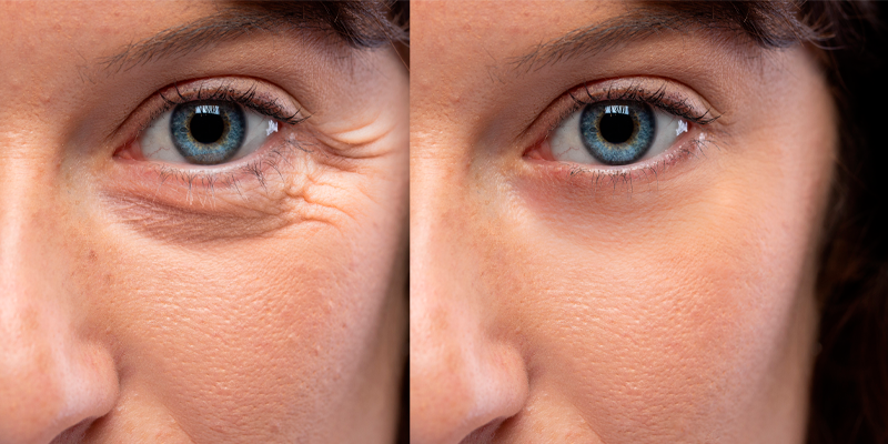 Suplementação de Colágeno: Mitos e Verdades Revelados