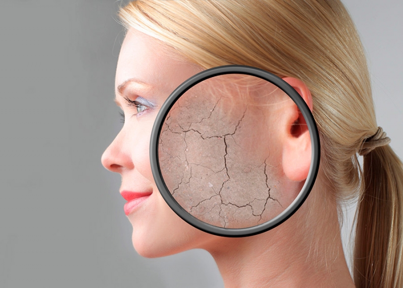 Como Evitar o Ressecamento da Pele com Banhos Quentes