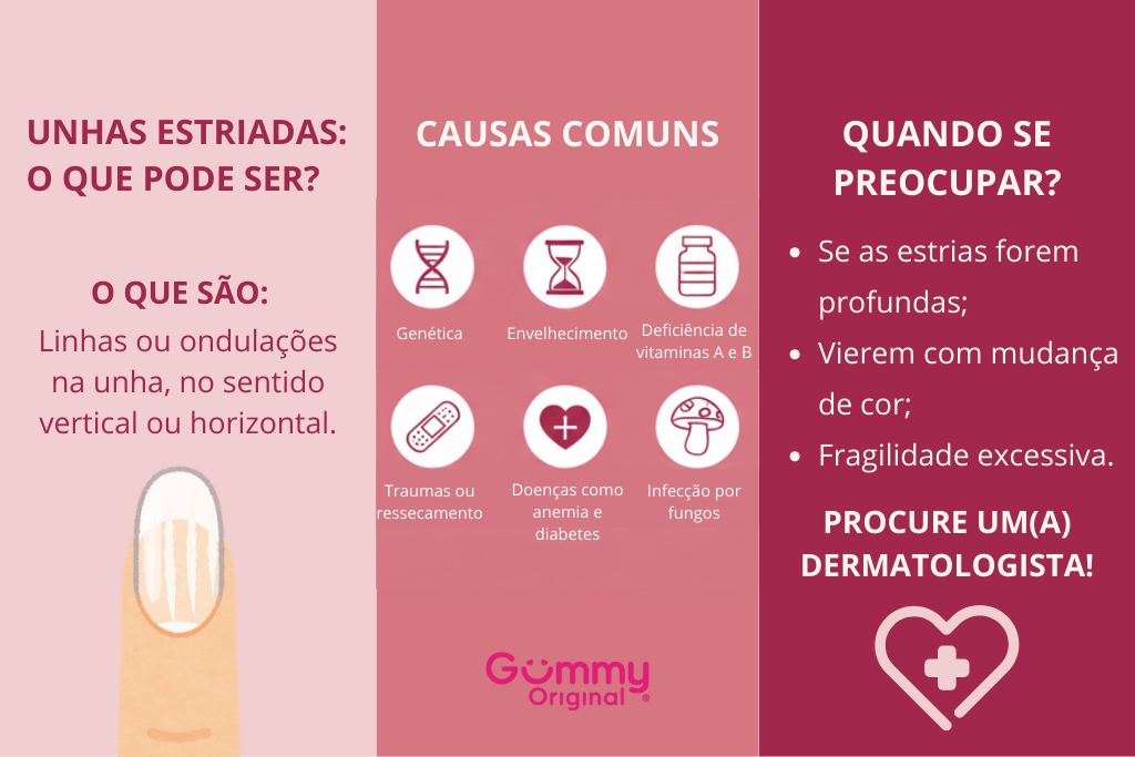 Os Melhores Produtos para Tratar Unhas Estriadas