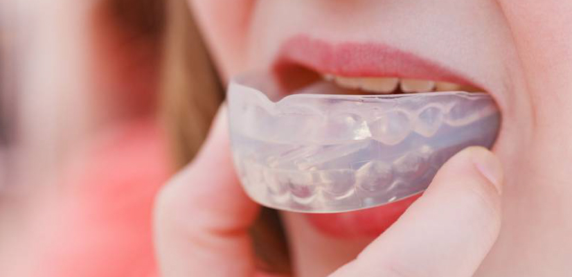 Guia Completo: Como Escolher o Protetor Bucal Perfeito para Cada Esporte