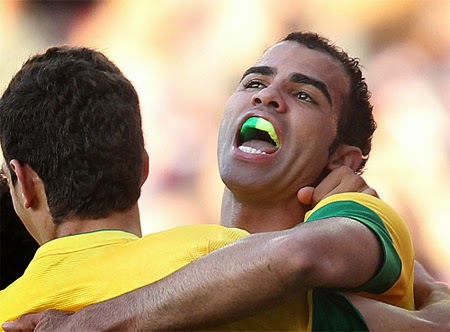 Protetor Bucal Moldável vs. Personalizado: Qual a Melhor Opção para Você?