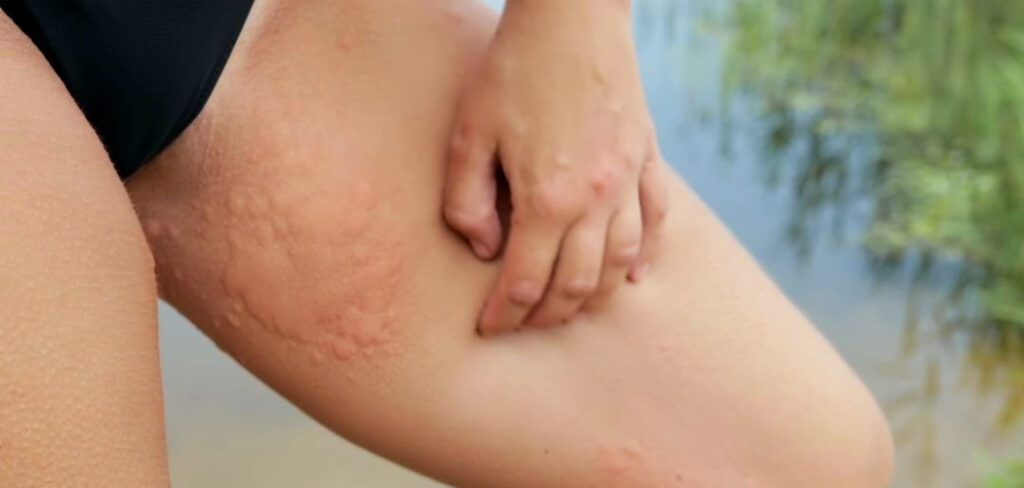 5 Dicas de Roupas para Evitar Assaduras em Trilhas