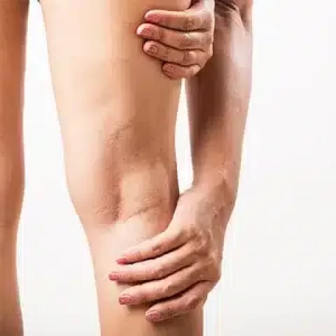 Como a Hidratação e a Dieta Afetam a Circulação das Pernas