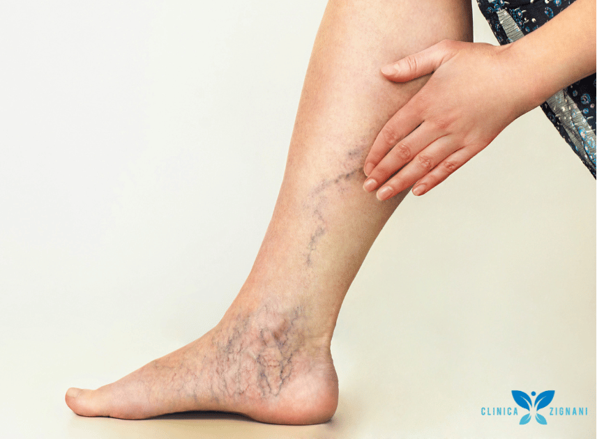 5 Exercícios Simples para Melhorar a Circulação das Pernas em Casa