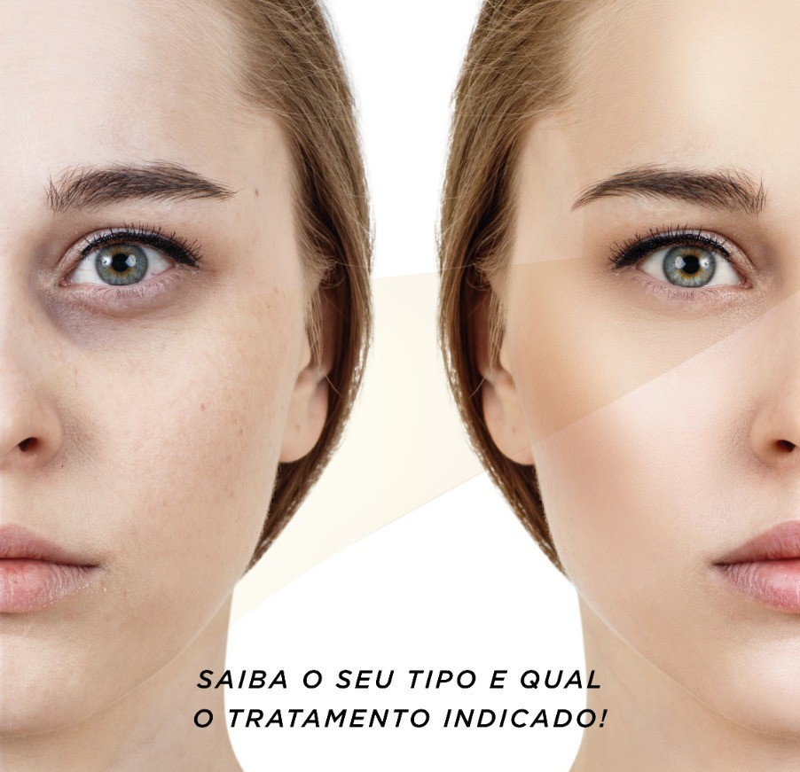 Como Escolher o Corretivo Ideal para Olheiras Escuras