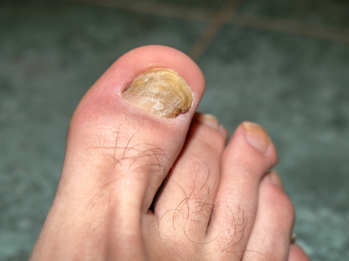 Bicarbonato de Sódio: A Solução Simples para Unhas Saudáveis