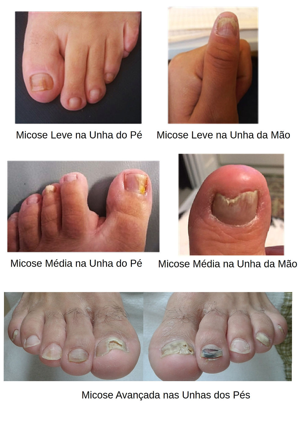 Bicarbonato de Sódio: A Solução Simples para Unhas Saudáveis