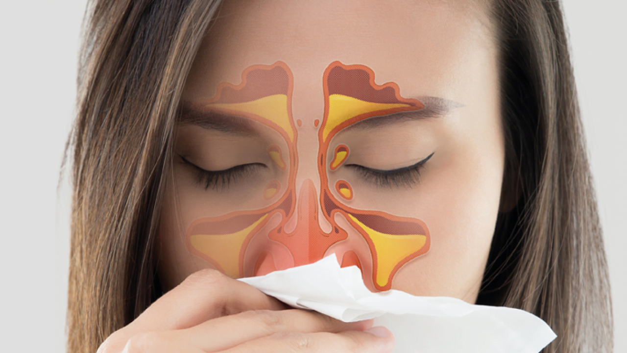 como tratar a rinite alérgica naturalmente