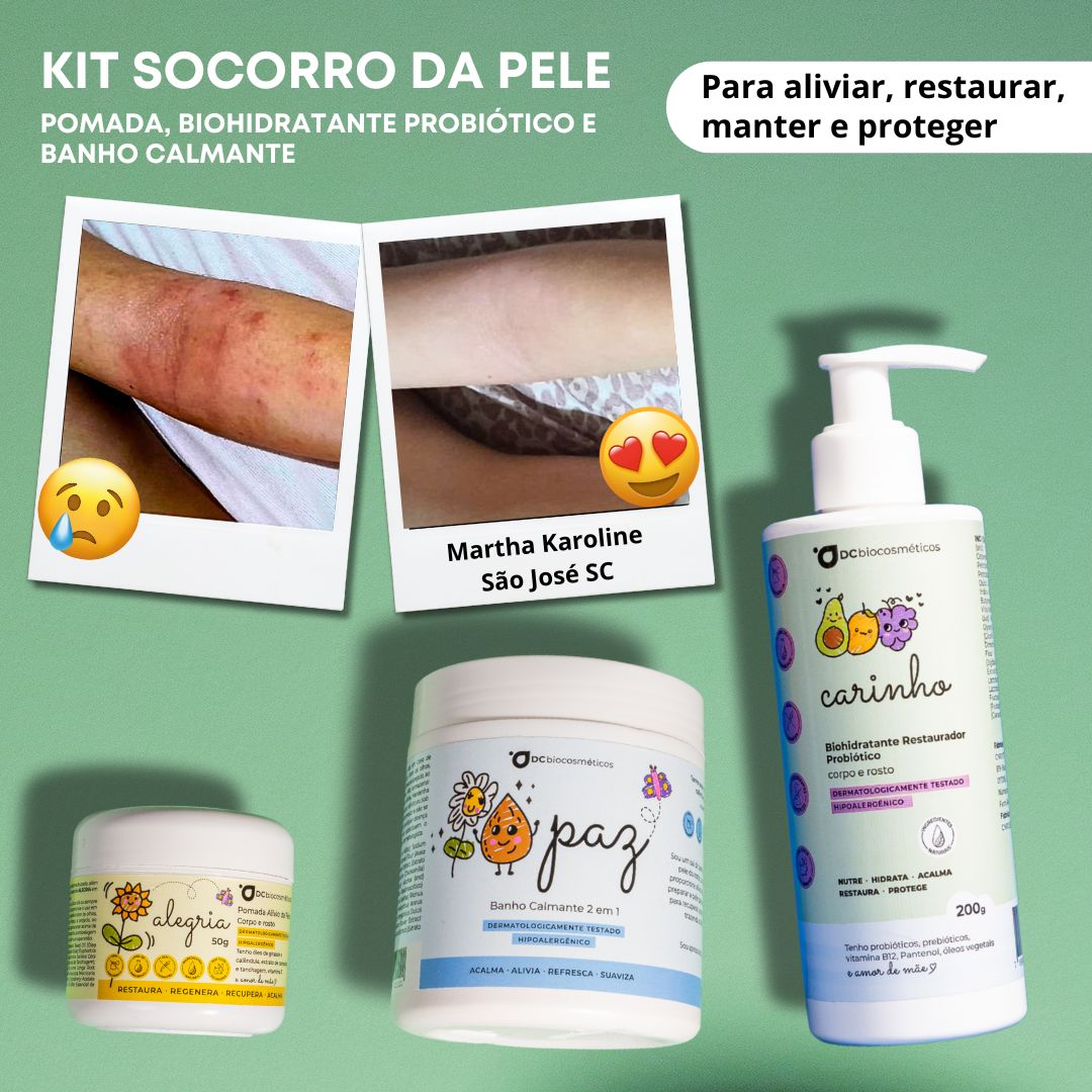 Dermatite de Contato: Identificando e Evitando Alérgenos Comuns