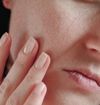 Como Usar Retinol sem Irritação