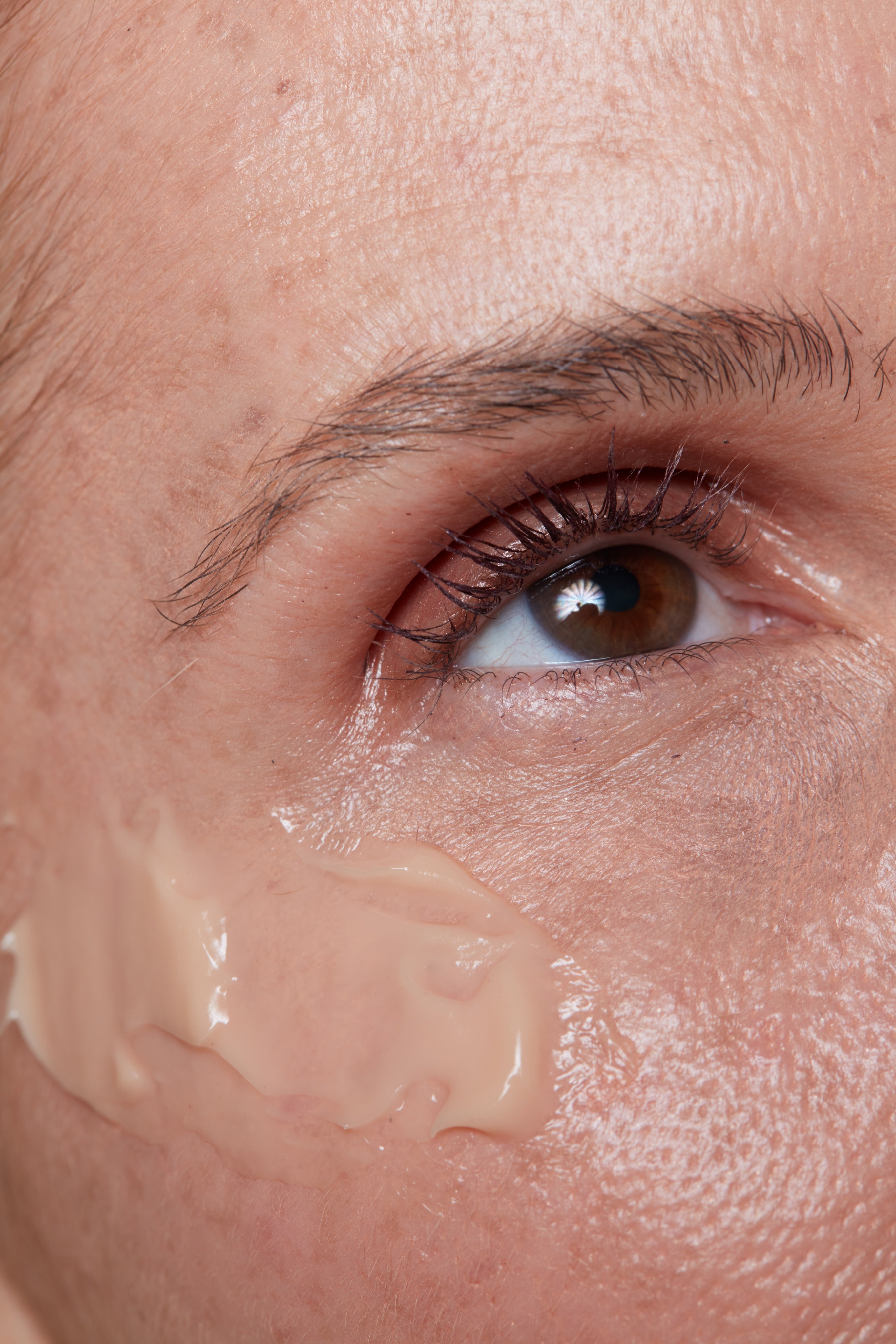 como tratar poros abertos no rosto