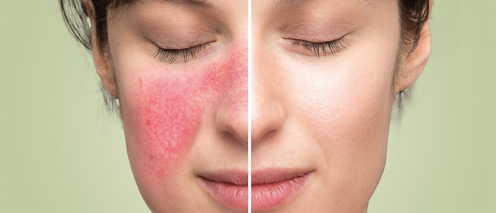 Guia Completo de Aloe Vera para Cuidados com a Pele