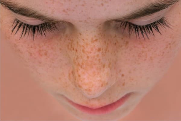 Guia completo de maquiagem para realçar sardas