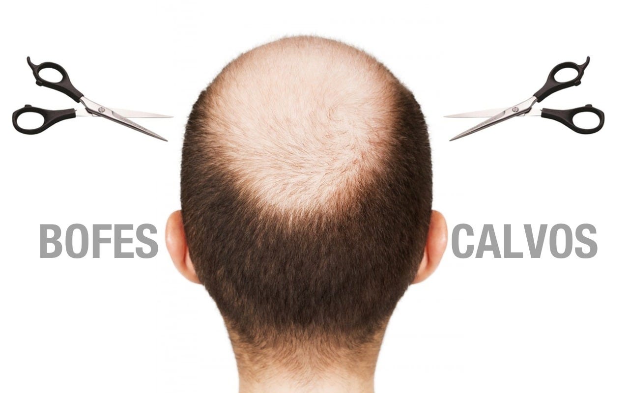 cortes de cabelo para homens calvos