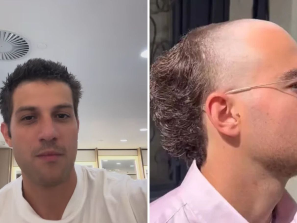 Como a Barba Pode Complementar seu Visual com Calvície