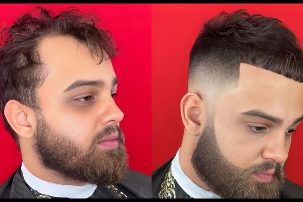 cortes de cabelo para homens calvos